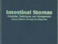 Intestinal Stomas; Principle, Techniques, and Management